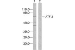 Western blot analysis of extracts from MDA-MB-435 cells, using ATF2 (Ab-112 or 94) Antibody.