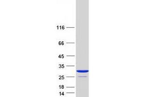 Validation with Western Blot