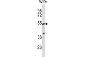 Western Blotting (WB) image for anti-Phosphatidylinositol Glycan Anchor Biosynthesis, Class V (PIGV) antibody (ABIN2997074) (PIGV anticorps)