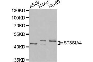 Western blot analysis of extracts of various cell lines, using ST8SIA4 Antibody.
