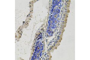 Immunohistochemistry of paraffin-embedded mouse lung using INHBB antibody at dilution of 1:100 (x40 lens). (INHBB anticorps)