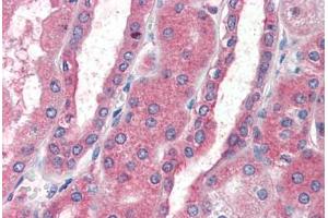 Human Kidney (formalin-fixed, paraffin-embedded) stained with CXCR4 antibody ABIN461996 at 5 ug/ml followed by biotinylated anti-goat IgG secondary antibody ABIN481715, alkaline phosphatase-streptavidin and chromogen.