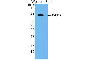 Western blot analysis of the recombinant protein. (TPM2 anticorps  (AA 1-284))