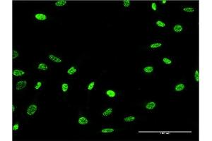 Immunofluorescence of monoclonal antibody to PTPN22 on HeLa cell. (PTPN22 anticorps  (AA 10-113))