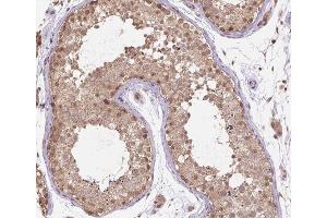 ABIN6266521 at 1/200 staining human testis tissue sections by IHC-P.