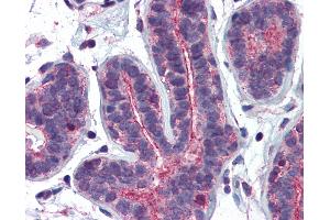 Anti-RHOA antibody IHC of human breast. (RHOA anticorps  (AA 1-194))