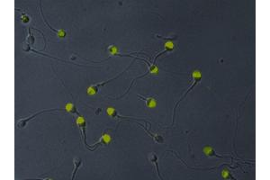 Immunocytochemistry analysis of VCP in acetone-permeabilized human sperms (normal spermiogram)using monoclonal antibody Hs-14 demonstrates its location to the acrosome.