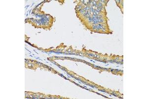 Immunohistochemistry of paraffin-embedded human prostate using CXCL11 antibody. (CXCL11 anticorps)