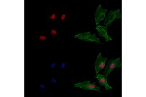 ABIN6265200 and ABIN6269069 staining  cells by IF/ICC. (SNAIL anticorps  (C-Term))
