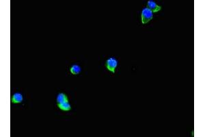 Immunofluorescent analysis of Hela cells using ABIN7171701 at dilution of 1:100 and Alexa Fluor 488-congugated AffiniPure Goat Anti-Rabbit IgG(H+L) (TTI1 anticorps  (AA 692-858))