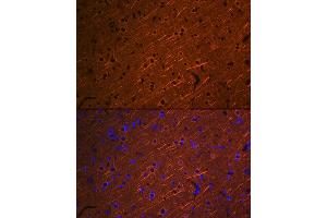 Immunofluorescence analysis of rat brain using βIII-Tubulin/β3-Tubulin Rabbit mAb (ABIN7271049) at dilution of 1:100 (40x lens). (TUBB3 anticorps)