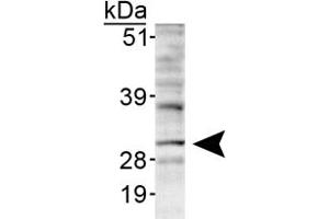 Western blot analysis of INSIG1 in HepG2 lyaste using INSIG1 polyclonal antibody . (INSIG1 anticorps  (AA 1-100))
