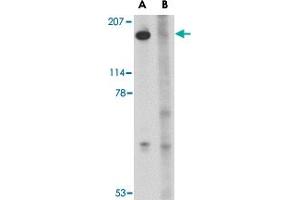 Western blot analysis of SLITRK5 in NIH/3T3 cell lysate with SLITRK5 polyclonal antibody  at 1 ug/mL in the (A) absence or (B) presence of blocking peptide.