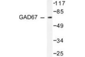 Image no. 2 for anti-Glutamate Decarboxylase 1 (Brain, 67kDa) (GAD1) antibody (ABIN265428) (GAD anticorps)