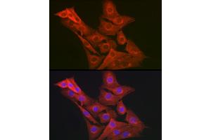 Immunofluorescence analysis of NIH-3T3 cells using GART Rabbit pAb (ABIN1679954, ABIN3018225, ABIN3018226 and ABIN6220407) at dilution of 1:200 (40x lens). (GART anticorps  (AA 1-320))