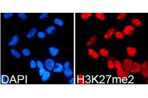Immunofluorescence analysis of 293T cells using DiMethyl-Histone H3-K27 antibody.
