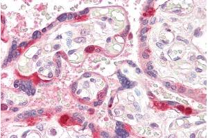 anti-rho Guanine Nucleotide Exchange Factor (GEF) 5 (ARHGEF5) (Internal Region) antibody