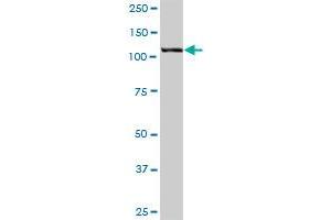HIP1 MaxPab polyclonal antibody.