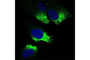 Immunofluorescence analysis of Hela cells using TWIST1 mouse mAb (green).