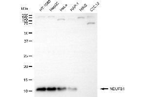 Western blotting analysis using NDUFB1 antibody (ABIN7799545). (Recombinant NDUFB1 anticorps)