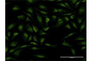 Immunofluorescence of monoclonal antibody to PTTG1 on HeLa cell.