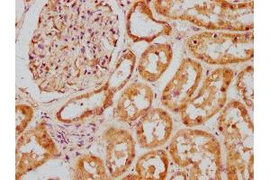 IHC image of ABIN7145242 diluted at 1:200 and staining in paraffin-embedded human kidney tissue performed on a Leica BondTM system. (BBS5 anticorps  (AA 224-317))