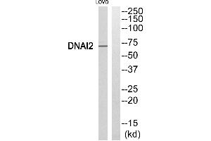 Western blot analysis of extracts from LOVO cells, using DNAI2 antibody.