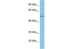 Host:  Rabbit  Target Name:  SMYD3  Sample Tissue:  Human Ovary Tumor  Antibody Dilution:  1ug/ml