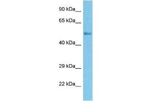 Host:  Rabbit  Target Name:  SMYD3  Sample Tissue:  Human Ovary Tumor  Antibody Dilution:  1ug/ml (SMYD3 anticorps  (N-Term))
