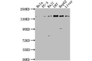 Western Blot Positive WB detected in: Hela whole cell lysate, PC-3 whole cell lysate, Raji whole cell lysate, U87 whole cell lysate, HepG2 whole cell lysate, Mouse liver tissue All lanes: MAP4K4 antibody at 1:1000 Secondary Goat polyclonal to rabbit IgG at 1/50000 dilution Predicted band size: 143, 139, 151, 134, 142, 146 kDa Observed band size: 143 kDa (MAP4K4 anticorps  (AA 866-1104))