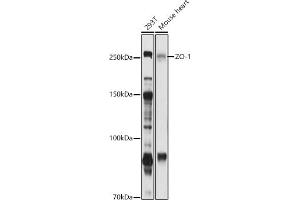 Western blot analysis of extracts of various cell lines, using ZO-1 antibody (ABIN6134745, ABIN6149194, ABIN6149195 and ABIN6215203) at 1:1000 dilution. (TJP1 anticorps  (AA 1600-1700))
