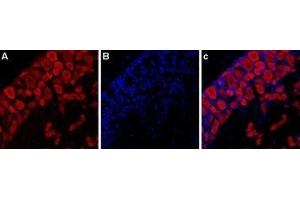 Expression of P2RX3 in rat DRG - Immunohistochemical staining of rat dorsal root ganglion (DRG) using Anti-P2X3 Receptor-ATTO Fluor-594 Antibody (ABIN7043421).
