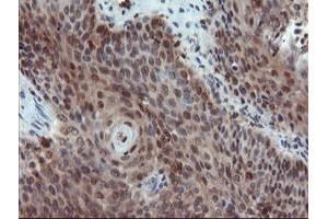 Image no. 5 for anti-PYD and CARD Domain Containing (PYCARD) antibody (ABIN1500518)