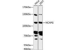 Western blot analysis of extracts of various cell lines, using NCAPG antibody (ABIN6130189, ABIN6144398, ABIN6144399 and ABIN6216998) at 1:3000 dilution. (NCAPG anticorps  (AA 610-700))