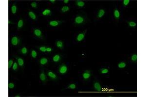 Immunofluorescence of monoclonal antibody to HNF4A on HeLa cell. (HNF4A anticorps  (AA 324-423))