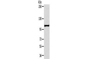 Gel: 6 % SDS-PAGE, Lysate: 40 μg, Lane: Mouse liver tissue, Primary antibody: ABIN7191695(NPR2 Antibody) at dilution 1/300, Secondary antibody: Goat anti rabbit IgG at 1/8000 dilution, Exposure time: 30 seconds (NPR2 anticorps)