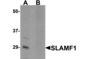 Western blot analysis of SLAMF1 in rat colon tissue lysate with SLAMF1 antibody at 1 μg/ml in (A) the absence and (B) the presence of blocking peptide (SLAMF1 anticorps  (N-Term))