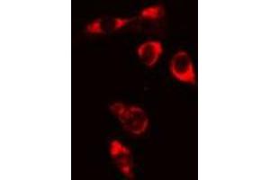 ABIN6276735 staining Hela cells by IF/ICC. (BTK anticorps  (Internal Region))