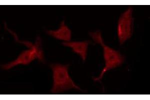 ABIN6267258 staining SK-OV3 by IF/ICC. (EGFR anticorps  (pThr678))