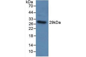 Western blot analysis of recombinant Human TLR5. (TLR5 anticorps  (AA 303-514))