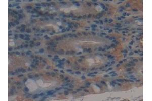 Detection of MRP1 in Mouse Intestine Tissue using Polyclonal Antibody to Multidrug Resistance Associated Protein 1 (MRP1)