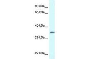 Image no. 1 for anti-PDZ and LIM Domain 1 (PDLIM1) (AA 216-265) antibody (ABIN6747329) (PDLIM1 anticorps  (AA 216-265))
