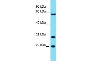 Host: Rabbit Target Name: FAM220A Sample Type: COLO205 Whole Cell lysates Antibody Dilution: 1. (Family with Sequence Similarity 220, Member A (FAM220A) (Middle Region) anticorps)