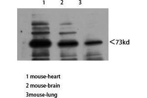 Western Blot (WB) analysis of Mouse Heart Mouse Brain Mouse Lung using Neuregulin-3 Polyclonal Antibody diluted at 1:800. (Neuregulin 3 anticorps  (Internal Region))