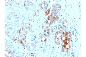Formalin-fixed, paraffin-embedded human Prostate stained with Ferritin, Light Chain Mouse Monoclonal Antibody (FTL/1387).