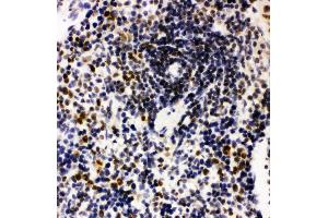 Anti-Nucleophosmin antibody, IHC(P) IHC(P): Rat Spleen Tissue (NPM1 anticorps  (N-Term))