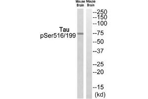 Western blot analysis of extracts from Mouse brain cells, using Tau (Phospho-Ser516/199) antibody. (MAPT anticorps  (pSer199, pSer516))