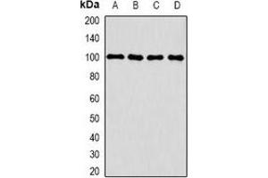 Western blot analysis of CLCN5 expression in HepG2 (A), THP1 (B), mouse kidney (C), mouse brain (D) whole cell lysates.