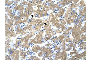 ACAT2 antibody was used for immunohistochemistry at a concentration of 4-8 ug/ml to stain Hepatocytes (arrows) in Human liver. (ACAT2 anticorps)
