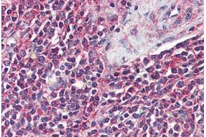 Anti-GPR43 antibody  ABIN1048823 IHC staining of human spleen. (FFAR2 anticorps  (Internal Region))